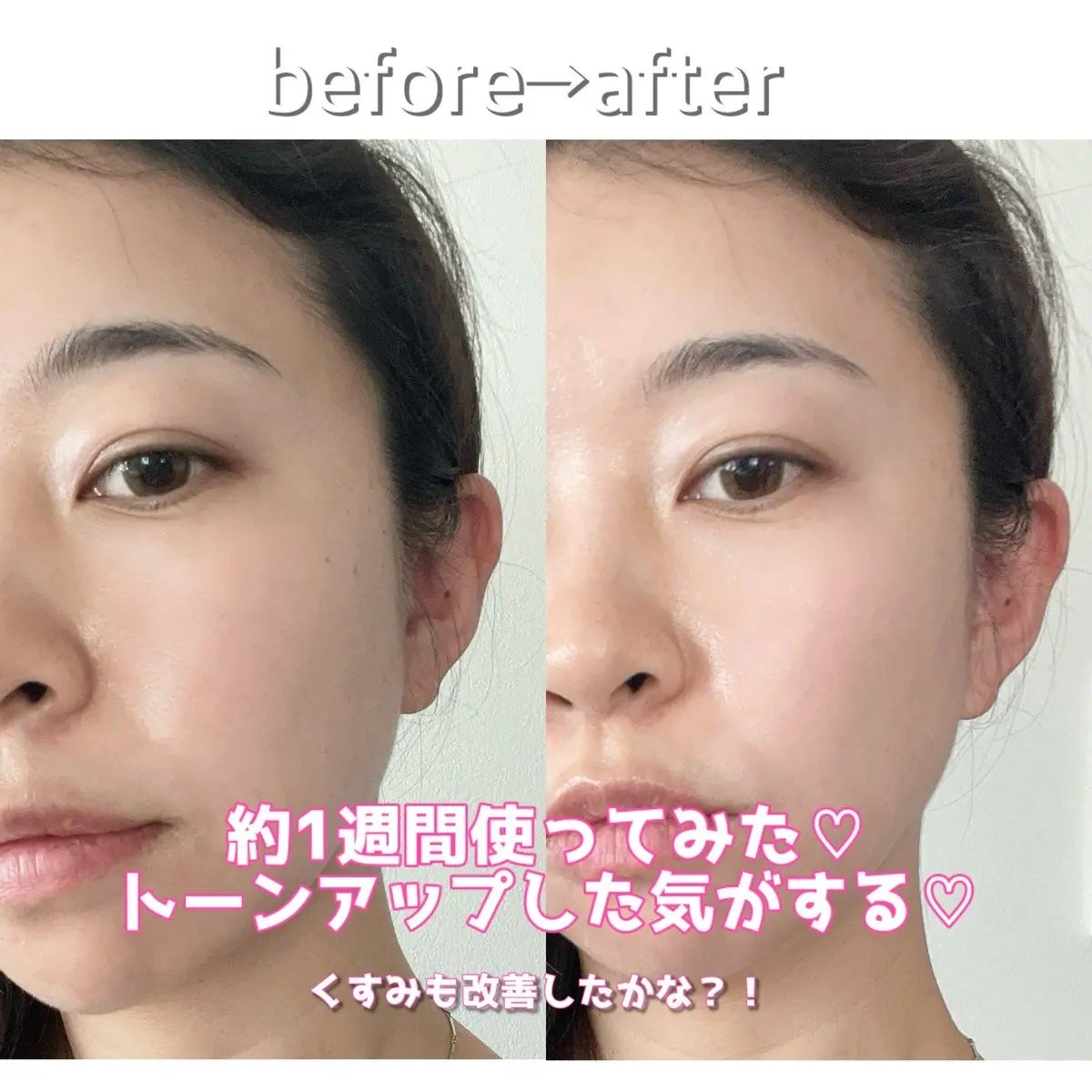 こままりえ@投稿ある方フォロバ✨ on LIPS 「メディテラピーの#アルブチンスキンブースターセラムと#トラネキ..」(3枚目)