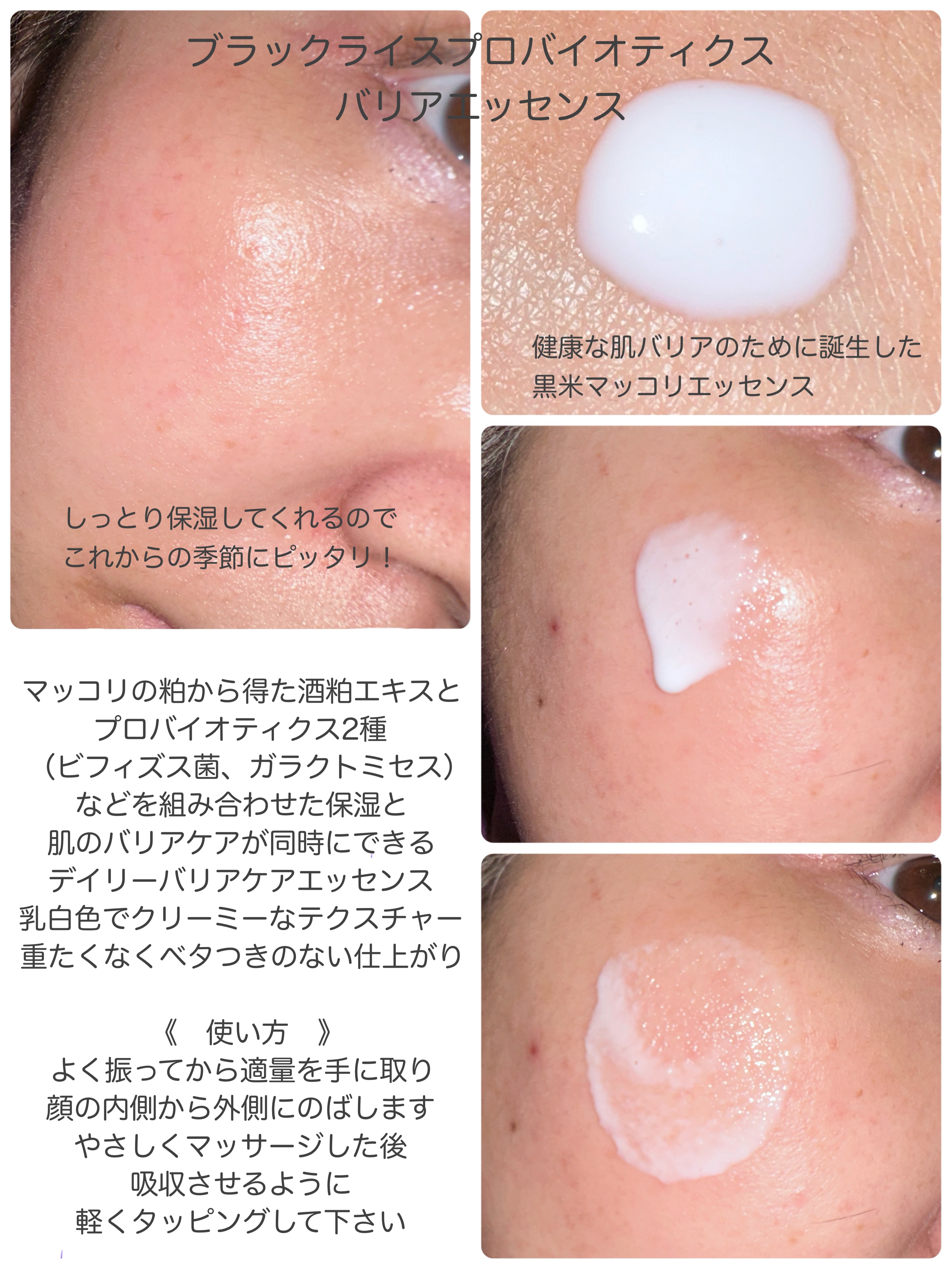 センテラフィト&5ペプチド コンセントレイトクリーム/haruharu wonder/フェイスクリームを使ったクチコミ（2枚目）