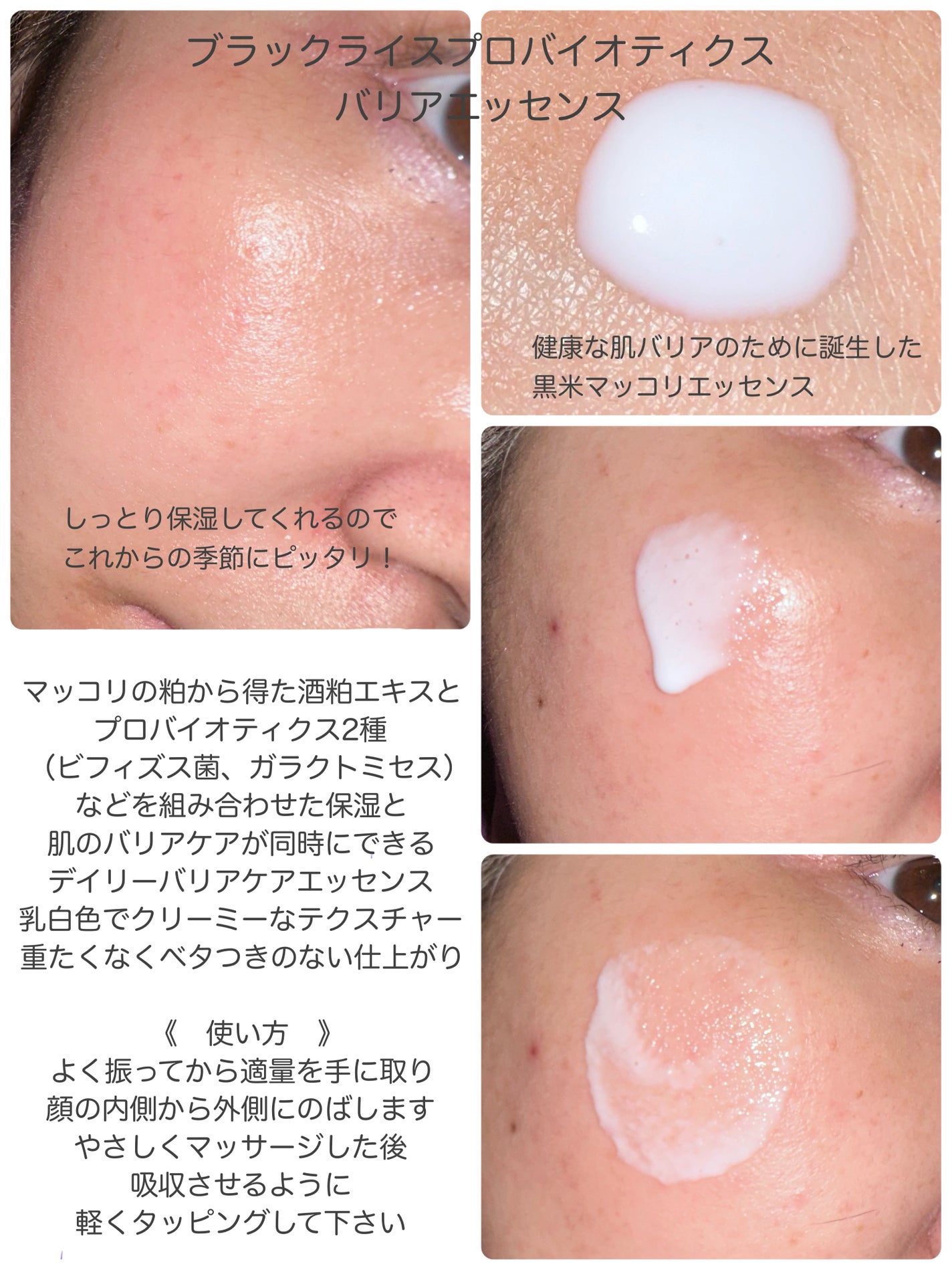 センテラフィト&5ペプチド コンセントレイトクリーム/haruharu wonder/フェイスクリームを使ったクチコミ(2枚目)