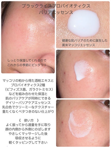 センテラフィト&5ペプチド コンセントレイトクリーム/haruharu wonder/フェイスクリームを使ったクチコミ(2枚目)