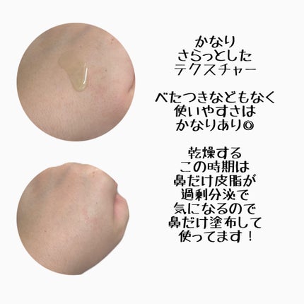 アゼライン酸15 インテンスカーミングセラム/Anua/美容液を使ったクチコミ(3枚目)