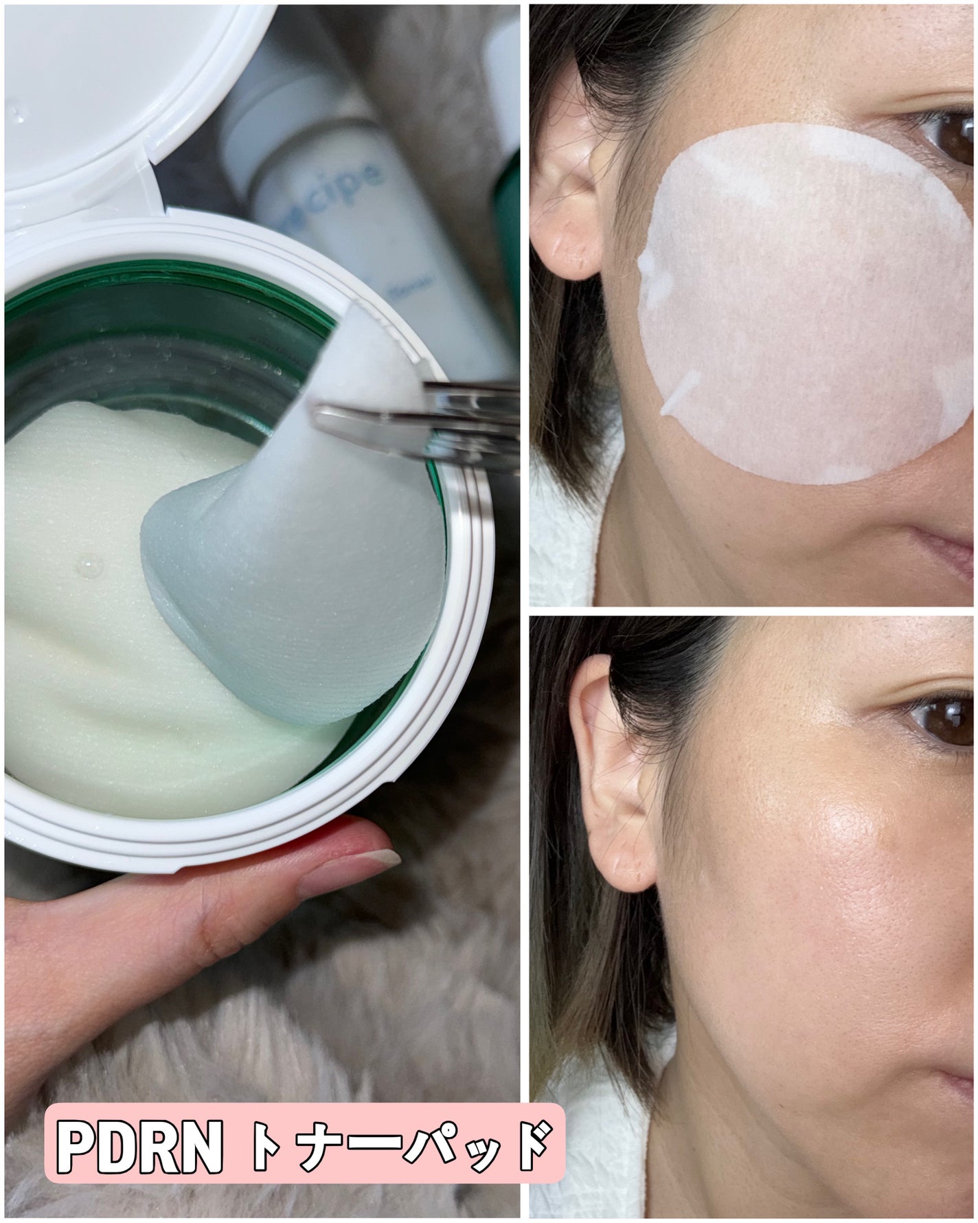 シカ PDRN 跡 クリアー トナーパッド/irecipe/トナーパッドを使ったクチコミ(4枚目)