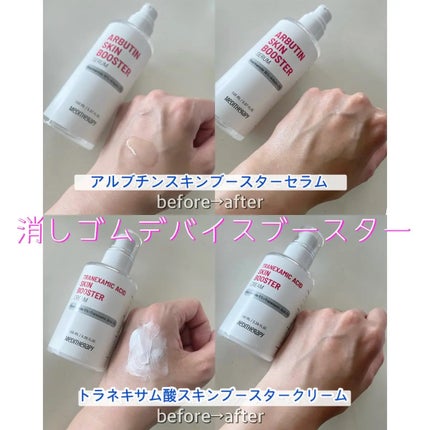 こままりえ@投稿ある方フォロバ✨ on LIPS 「メディテラピーの#アルブチンスキンブースターセラムと#トラネキ..」(4枚目)