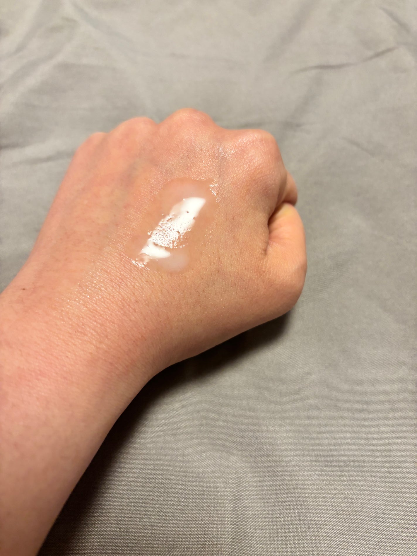 ダーマアンサーPDRNトナー/CNP Laboratory/化粧水を使ったクチコミ(5枚目)