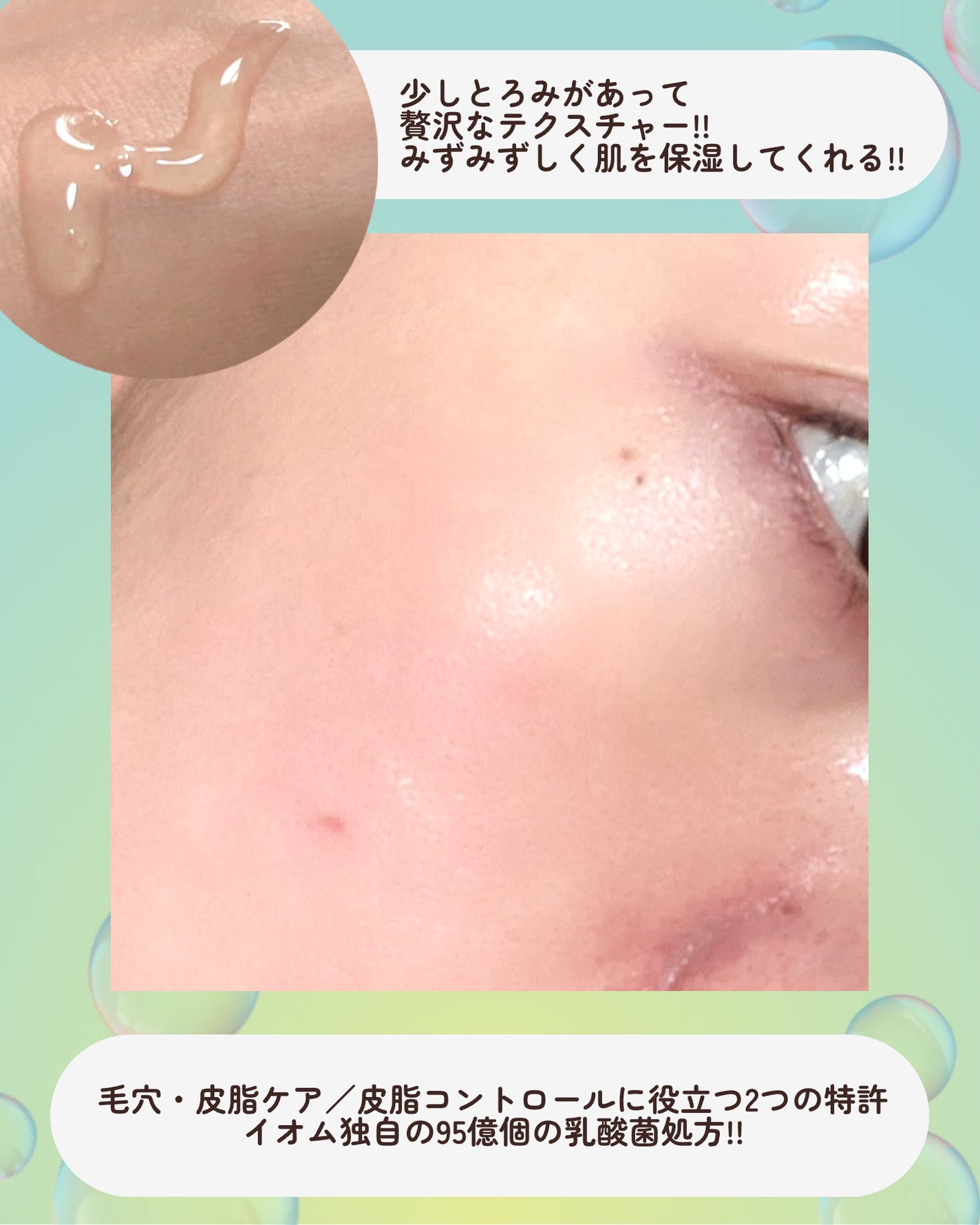 トラブルターゲティングセラム/EIOM/美容液を使ったクチコミ(8枚目)