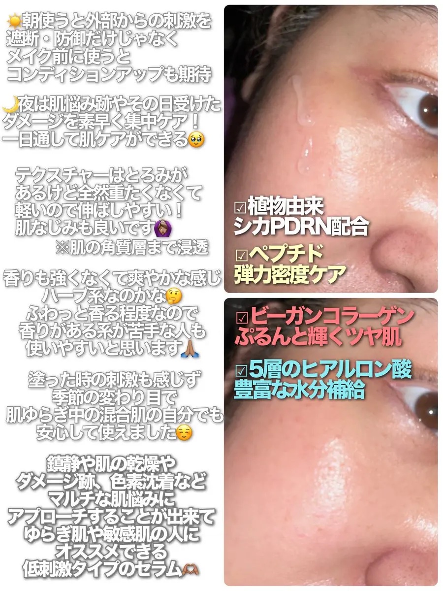 シカ PDRN 跡 クリアセラム/irecipe/美容液を使ったクチコミ（2枚目）