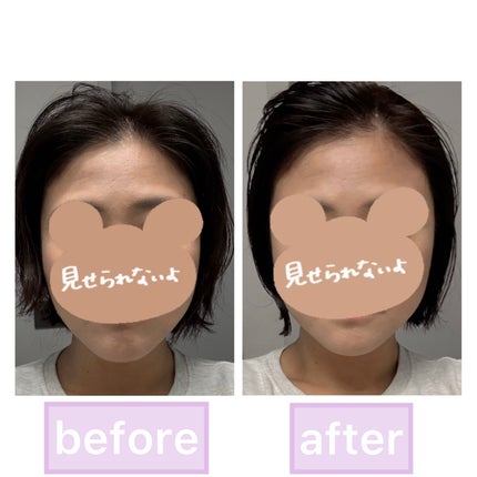 リカバリー オイルエッセンス/treecell/アウトバストリートメントを使ったクチコミ(4枚目)