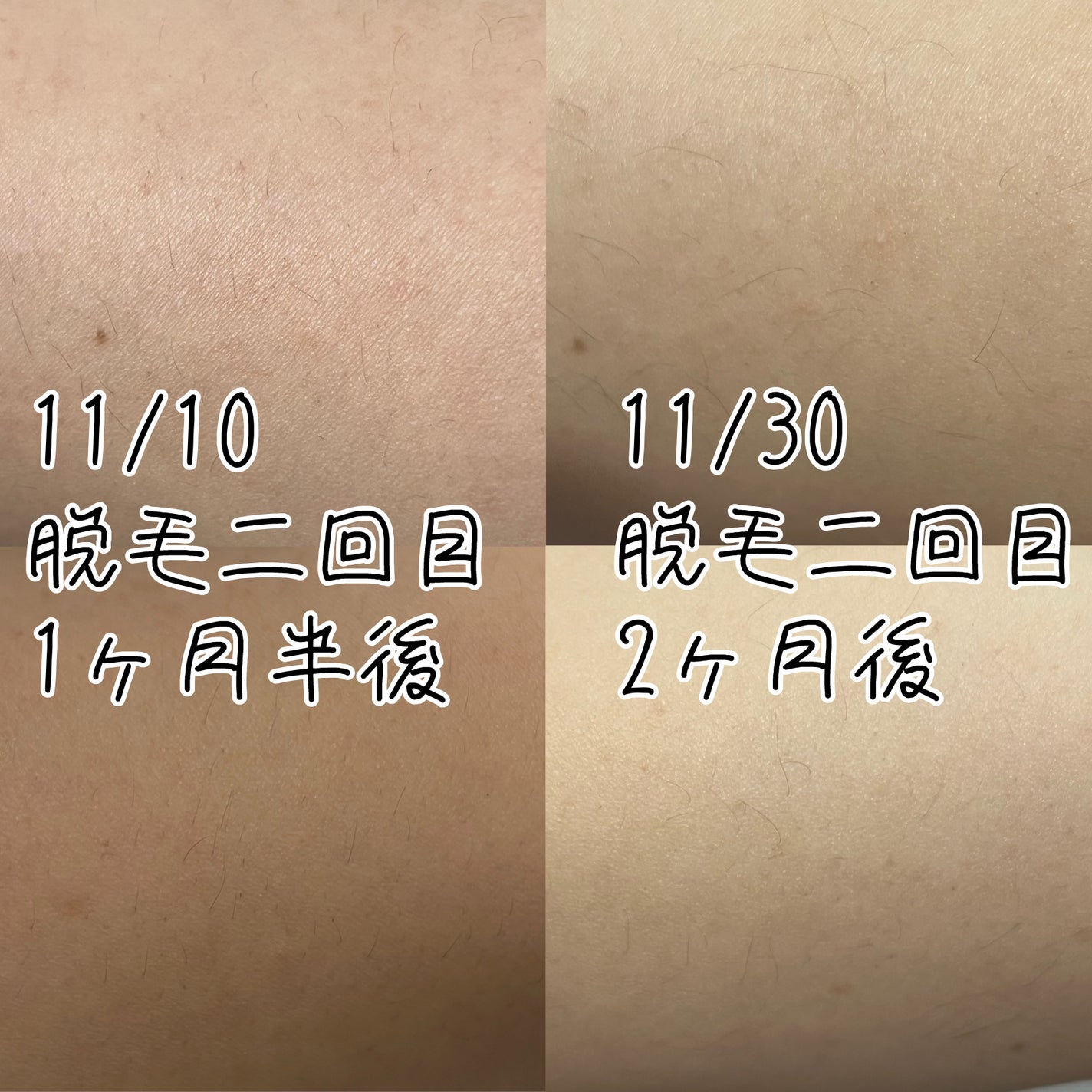 フェリエ ボディ用 ES-WR50-P/Panasonic/シェーバーを使ったクチコミ(2枚目)