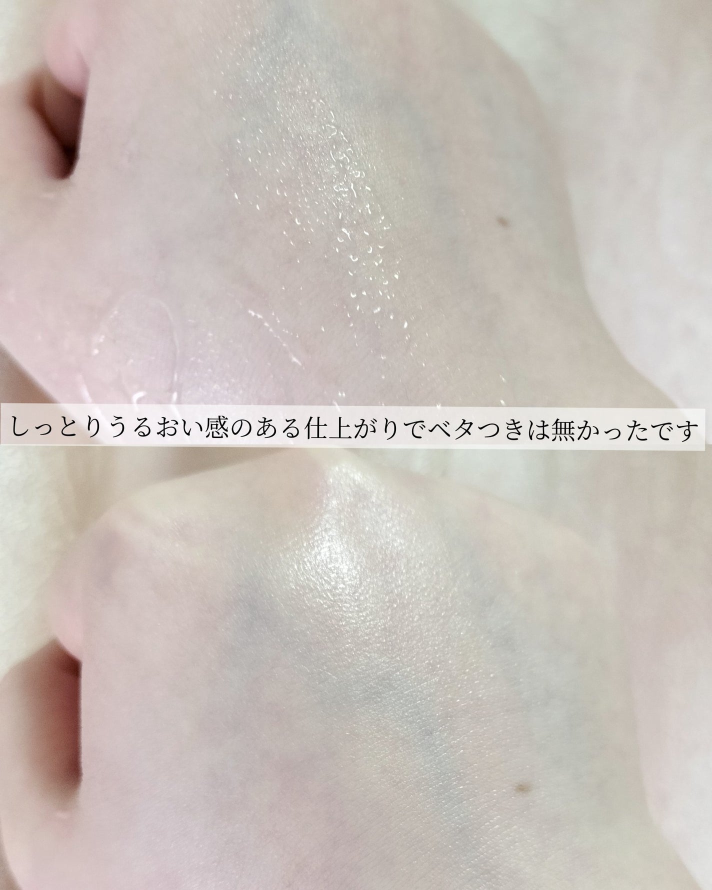 ã€ã³ãžã§ã¹ã¯ NM ïŒïŒïŒïŒïŒ ãã¥ãª ããªãã ã»ã©ã /INJESK/çŸå®¹æ¶²ã䜿ã£ãã¯ãã³ãïŒ6æç®ïŒ