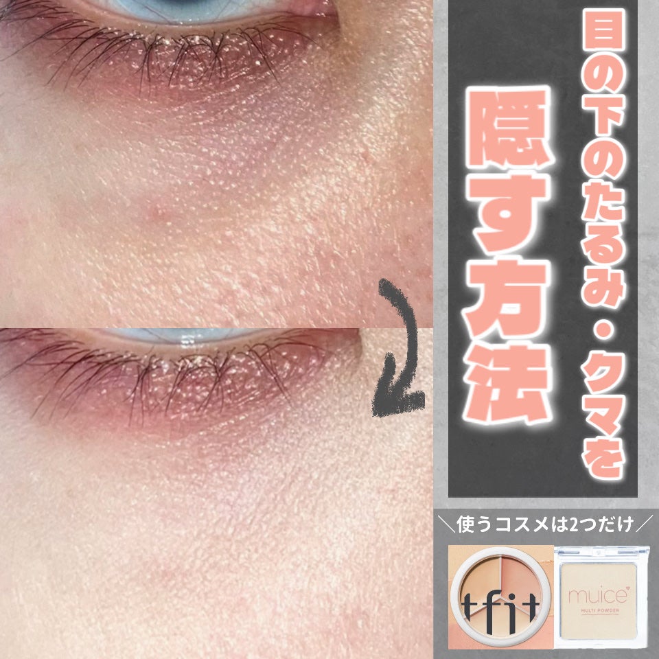 スポットメンテパウダー/muice/プレストパウダーを使ったクチコミ(1枚目)