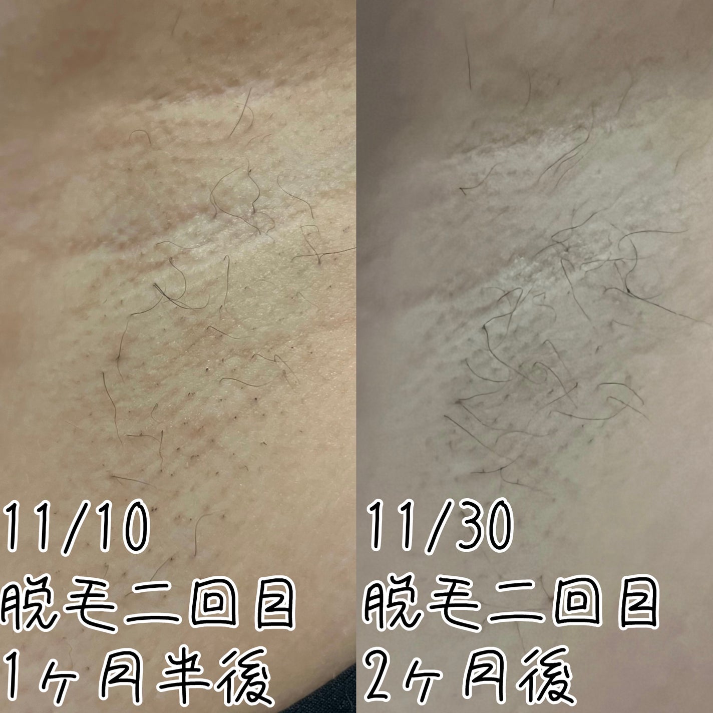 フェリエ ボディ用 ES-WR50-P/Panasonic/シェーバーを使ったクチコミ(4枚目)