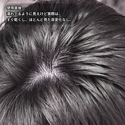 アデノバイタル スカルプ パワーショット/サブリミック/頭皮ローションを使ったクチコミ(5枚目)