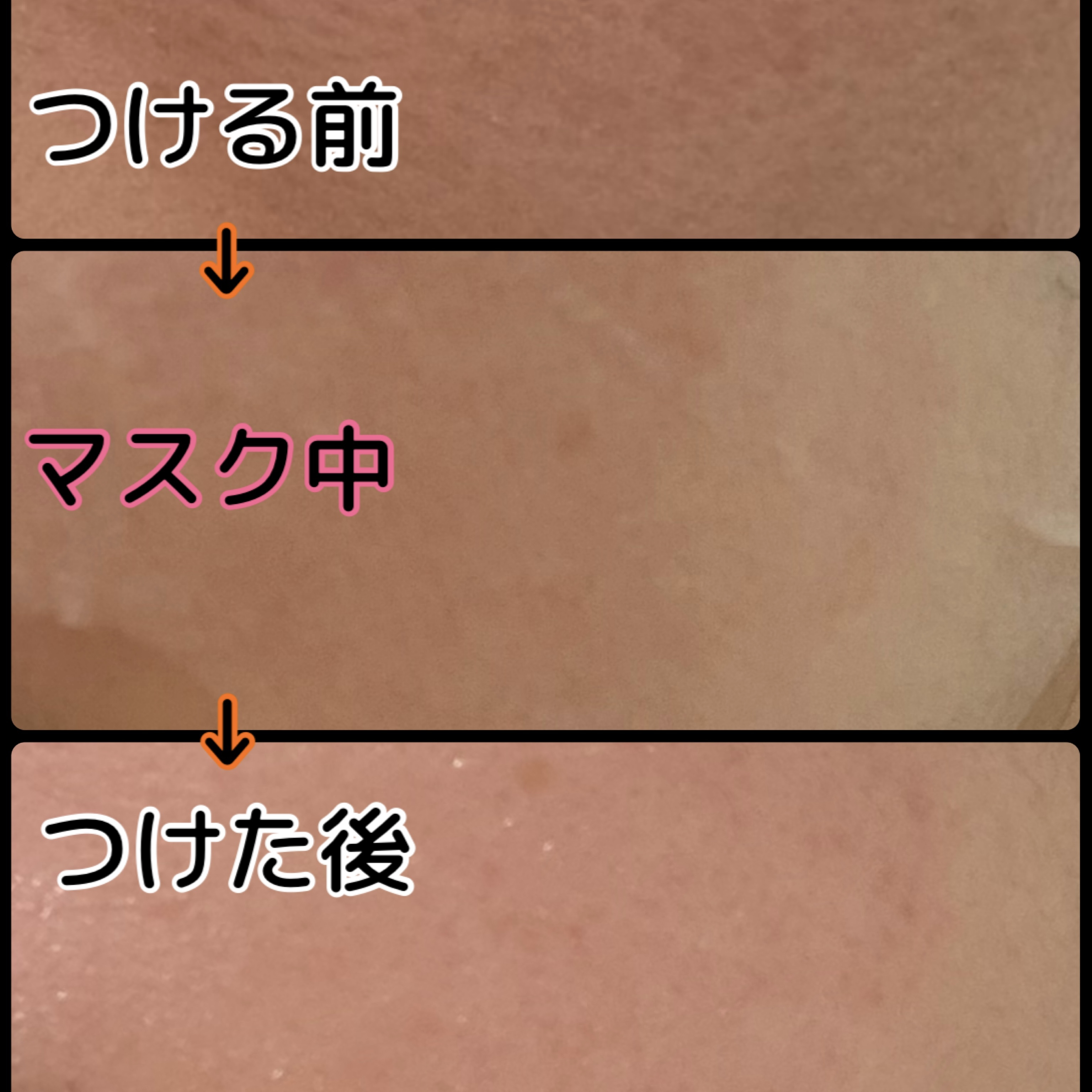 VC+3 Bright Banana Peel Mask/LIALUSTER/シートマスク・パックを使ったクチコミ（2枚目）