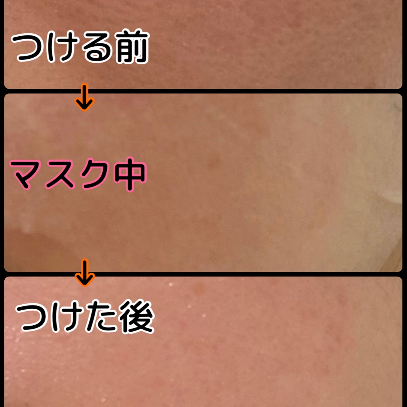 VC+3 Bright Banana Peel Mask/LIALUSTER/シートマスク・パックを使ったクチコミ(2枚目)