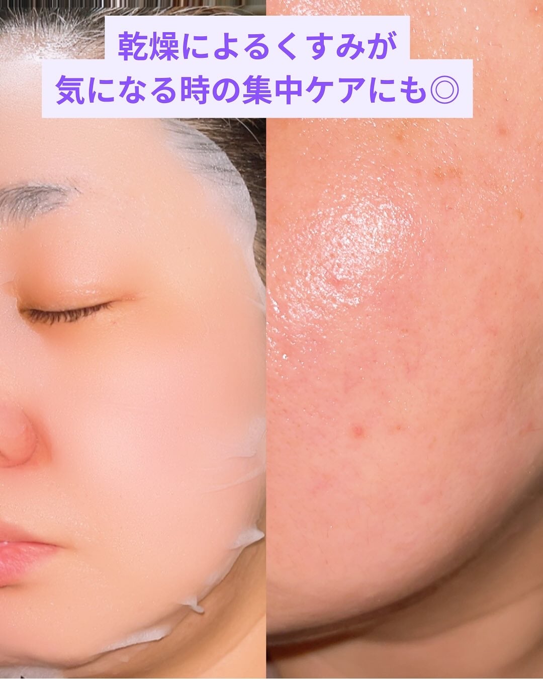 PDRN リフティングマスク/MEDIHEAL/シートマスク・パックを使ったクチコミ(4枚目)