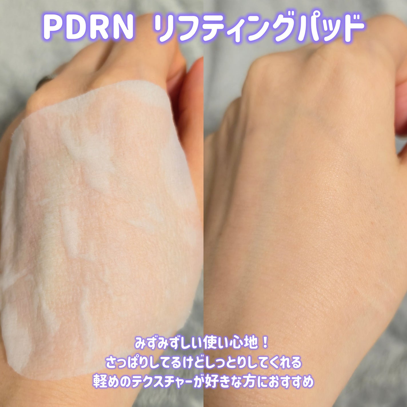 マデカソサイド ブレミッシュパッド/MEDIHEAL/トナーパッドを使ったクチコミ(3枚目)