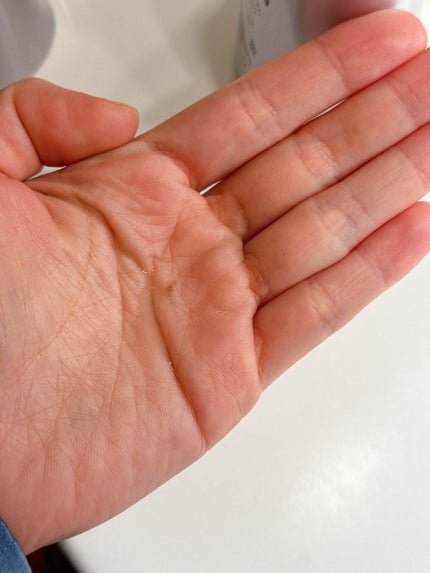 アデノバイタル スカルプ パワーショット/サブリミック/頭皮ローションを使ったクチコミ(3枚目)