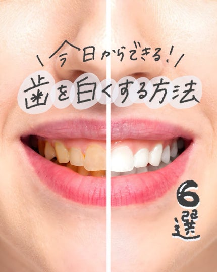 ホワイトパープル歯みがき ピーチフローラルミントの香り/EUTHYMOL/歯磨き粉を使ったクチコミ(1枚目)