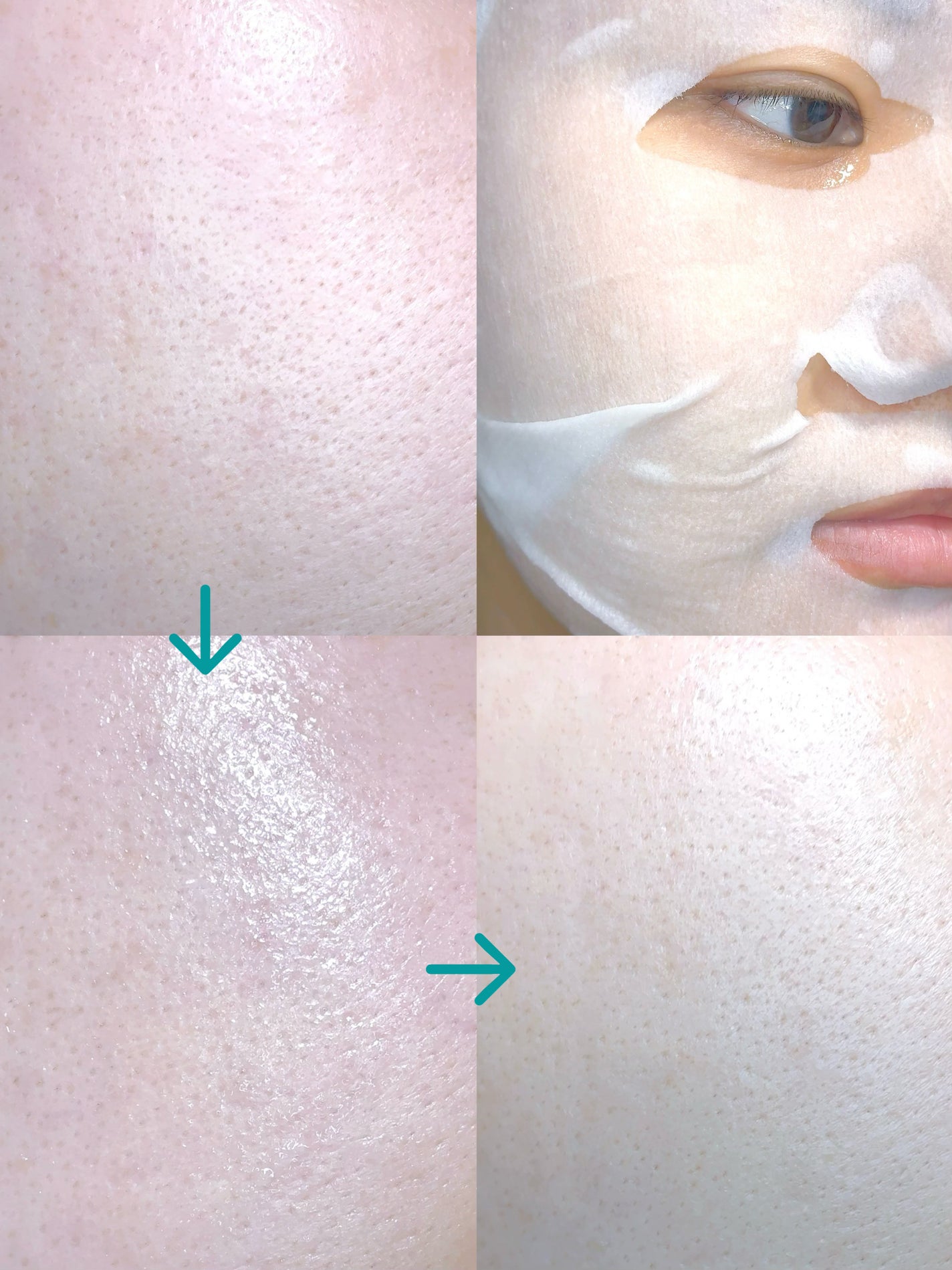 ルルルンプレシャス GREEN(Glow Up)/ルルルン/シートマスク・パックを使ったクチコミ(4枚目)