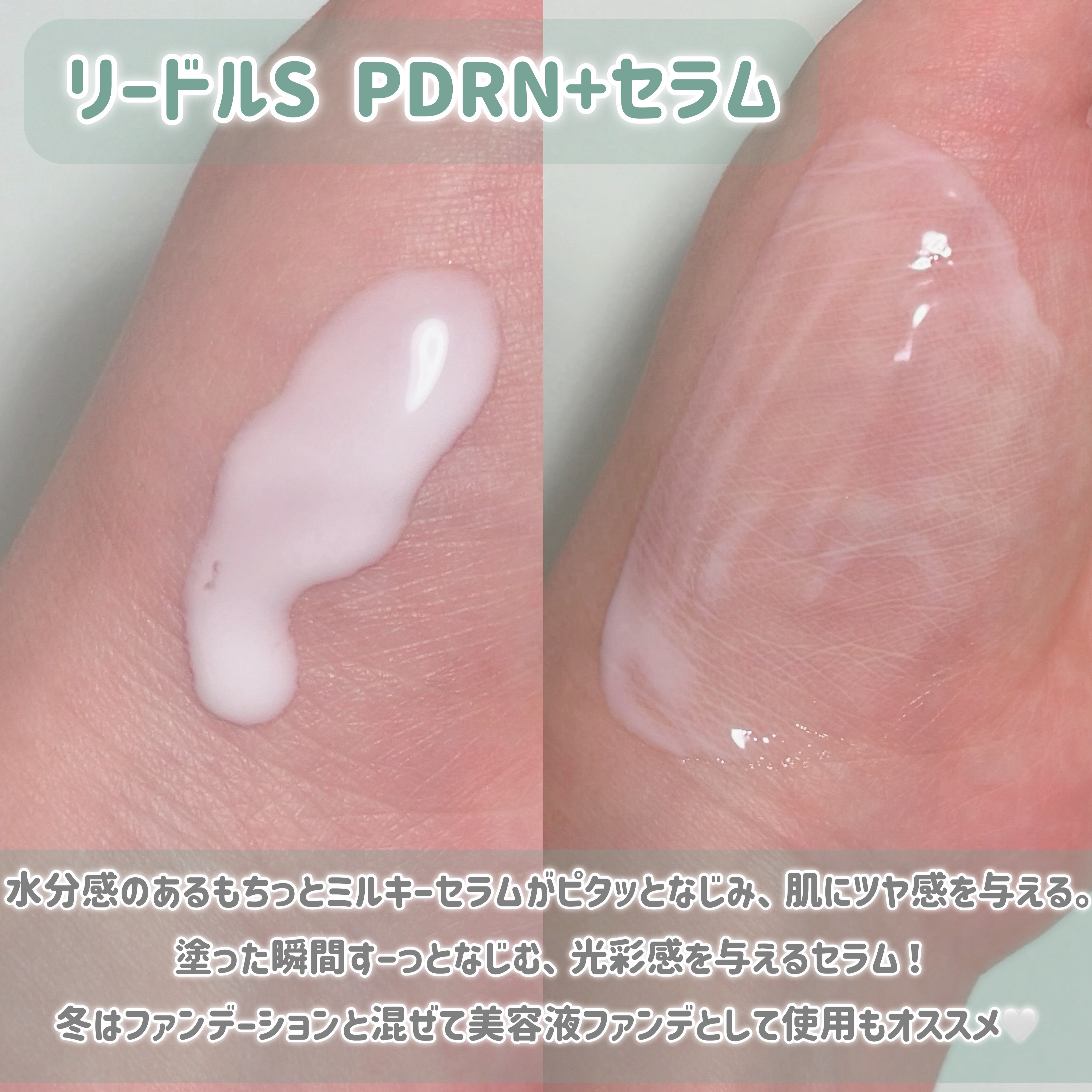 リードルS PDRN+ セラム/VT/美容液を使ったクチコミ（3枚目）