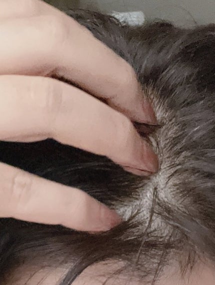 ほま on LIPS 「.ーーーーーーーーーーーーーーーーーーーーーアデノバイタル..」(2枚目)