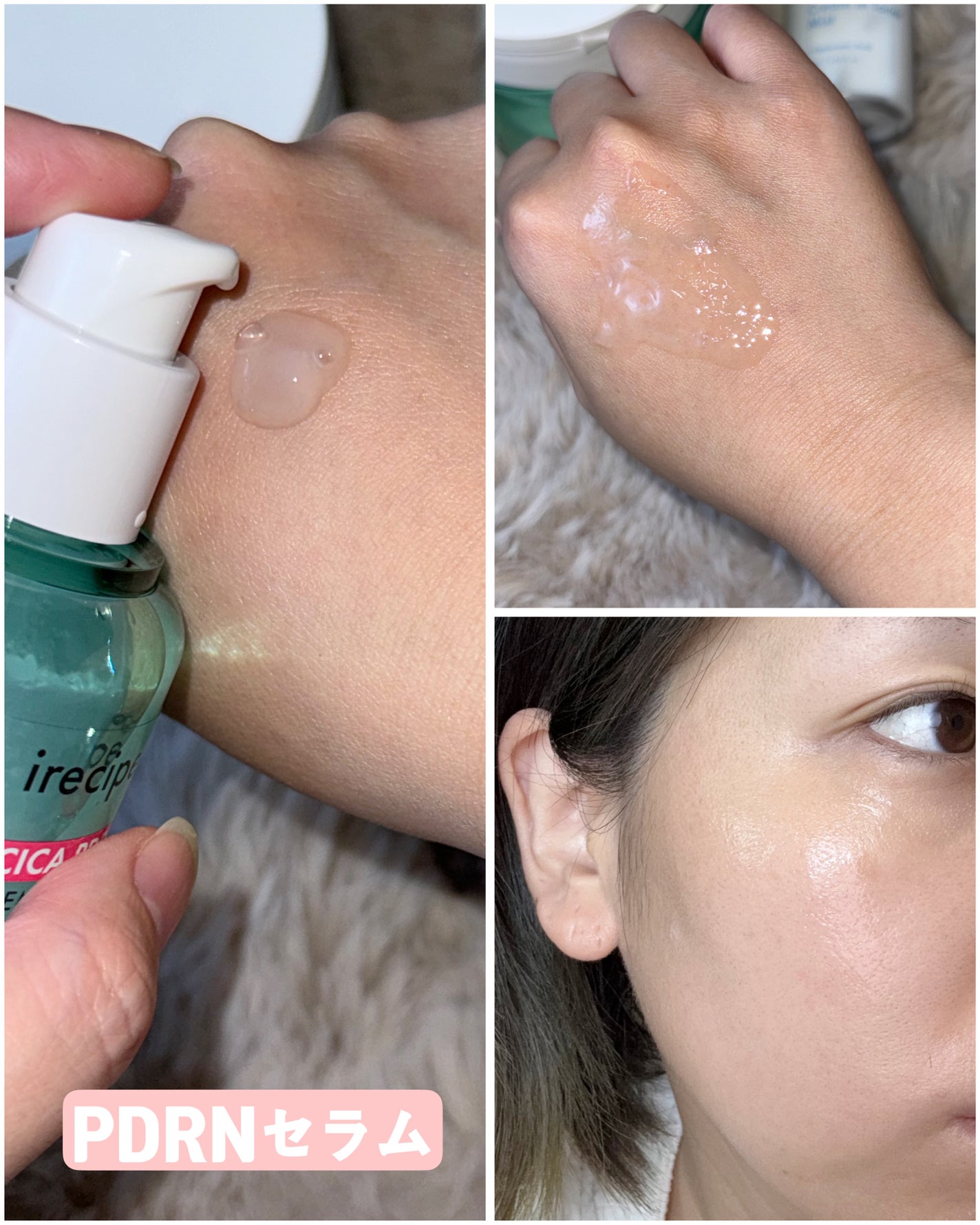 シカ PDRN 跡 クリアー トナーパッド/irecipe/トナーパッドを使ったクチコミ(2枚目)