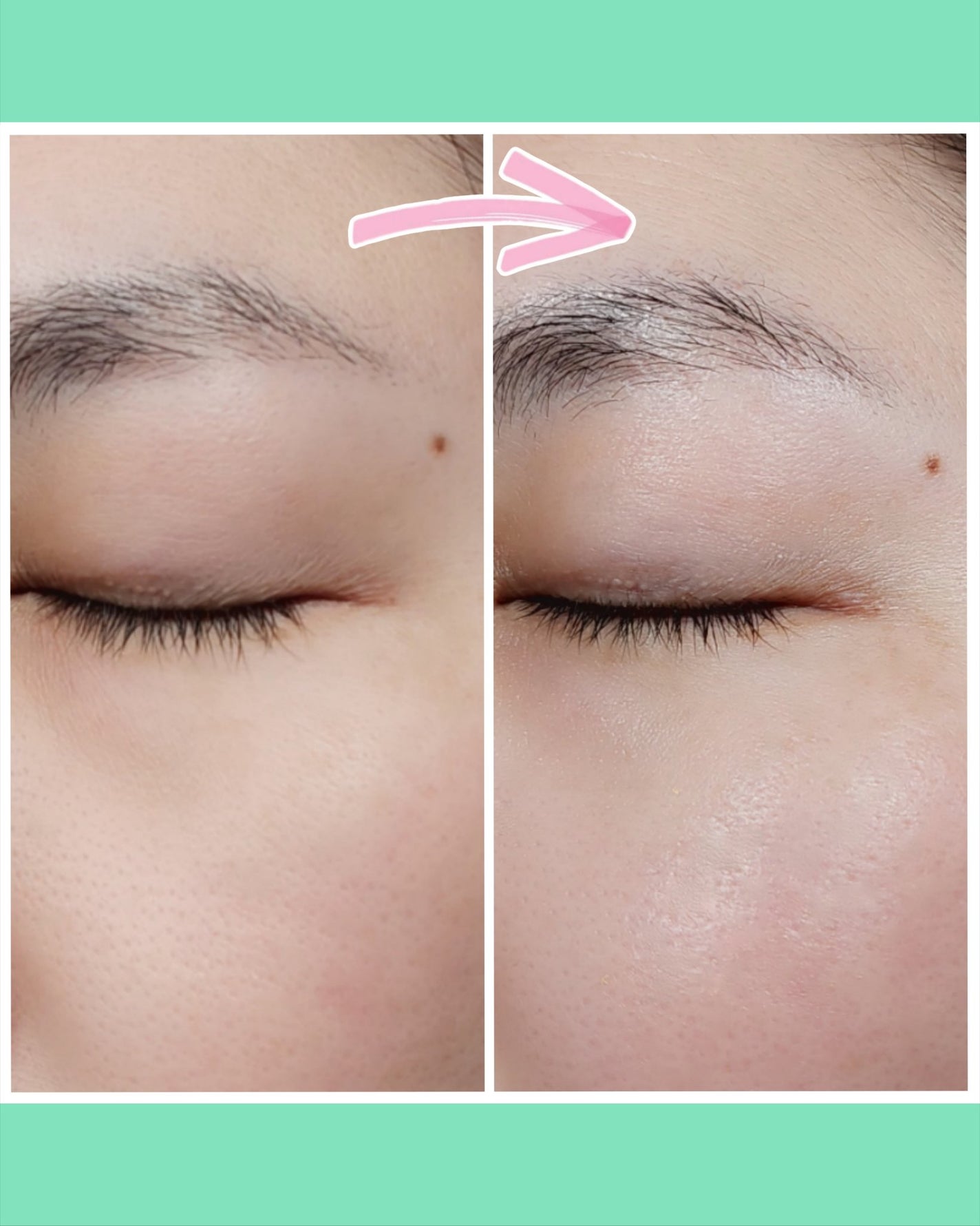 リードルS PDRN+ セラム/VT/美容液を使ったクチコミ(6枚目)