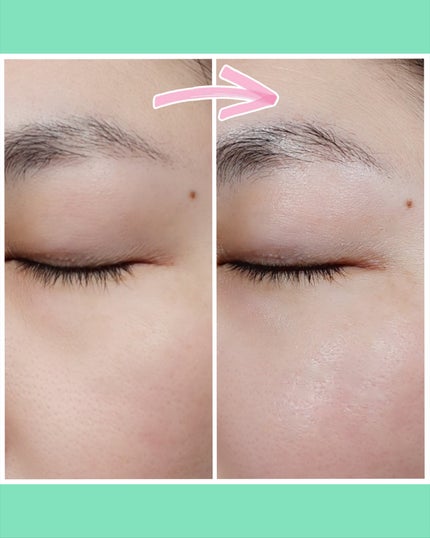 リードルS PDRN+ セラム/VT/美容液を使ったクチコミ(6枚目)