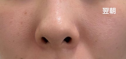 フローリフティングラッピングクリーム/koy/フェイスクリームを使ったクチコミ(5枚目)