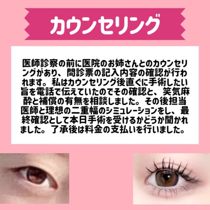 五月@正直レビュー on LIPS 「【水の森で二重埋没した結果📖】カウンセリング予約~術後まで全て..」(5枚目)