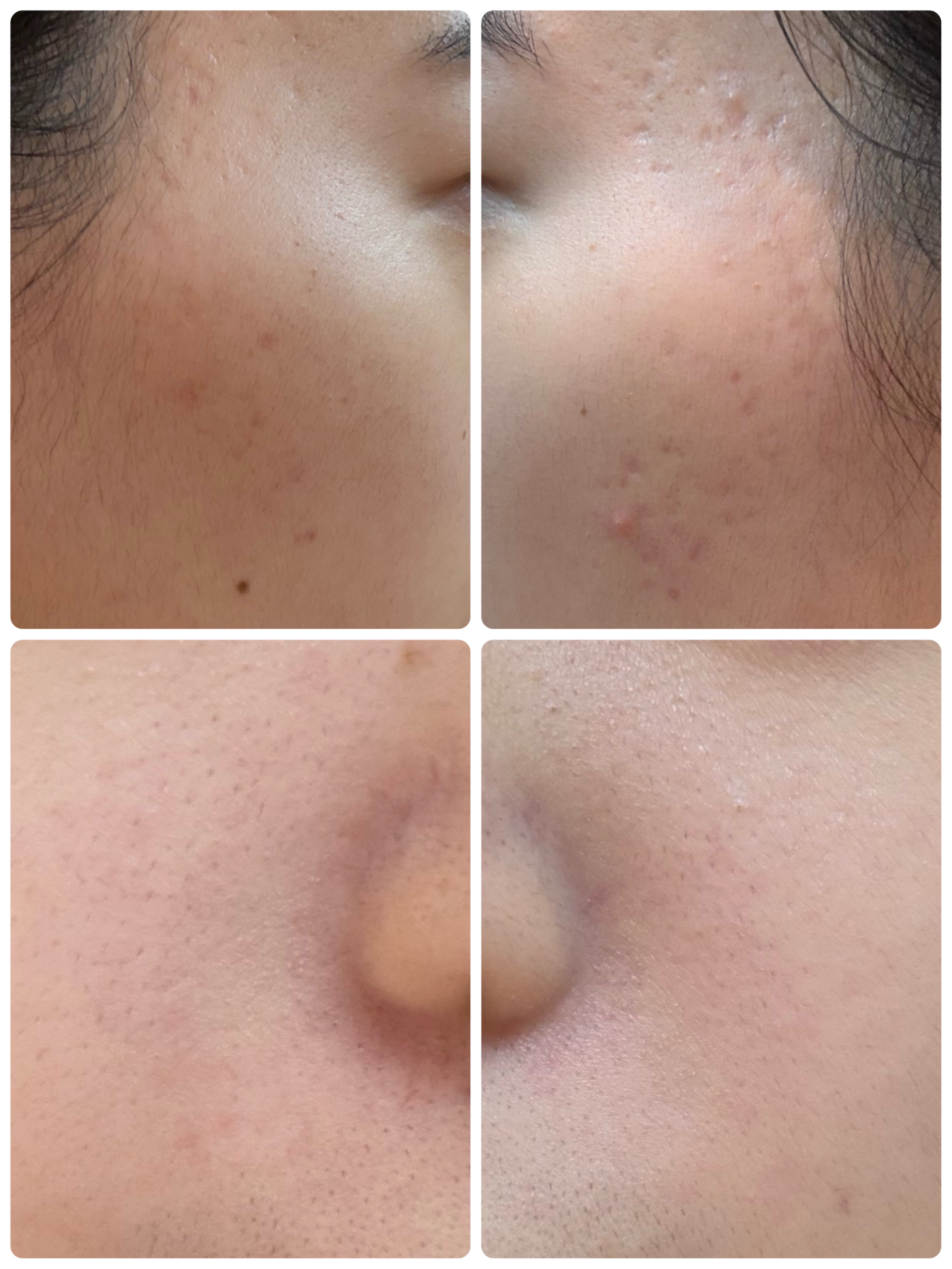 AGE-R ブースタープロ/MEDICUBE/美顔器・マッサージを使ったクチコミ（2枚目）