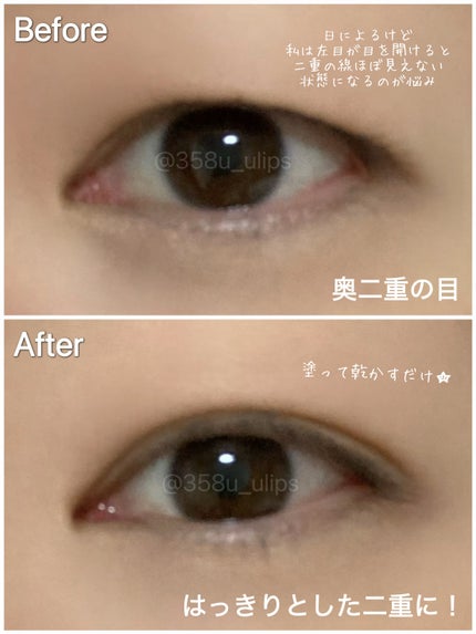 オリシキ アイリッドスキンフィルム EX/D-UP/二重まぶた用アイテムを使ったクチコミ(3枚目)