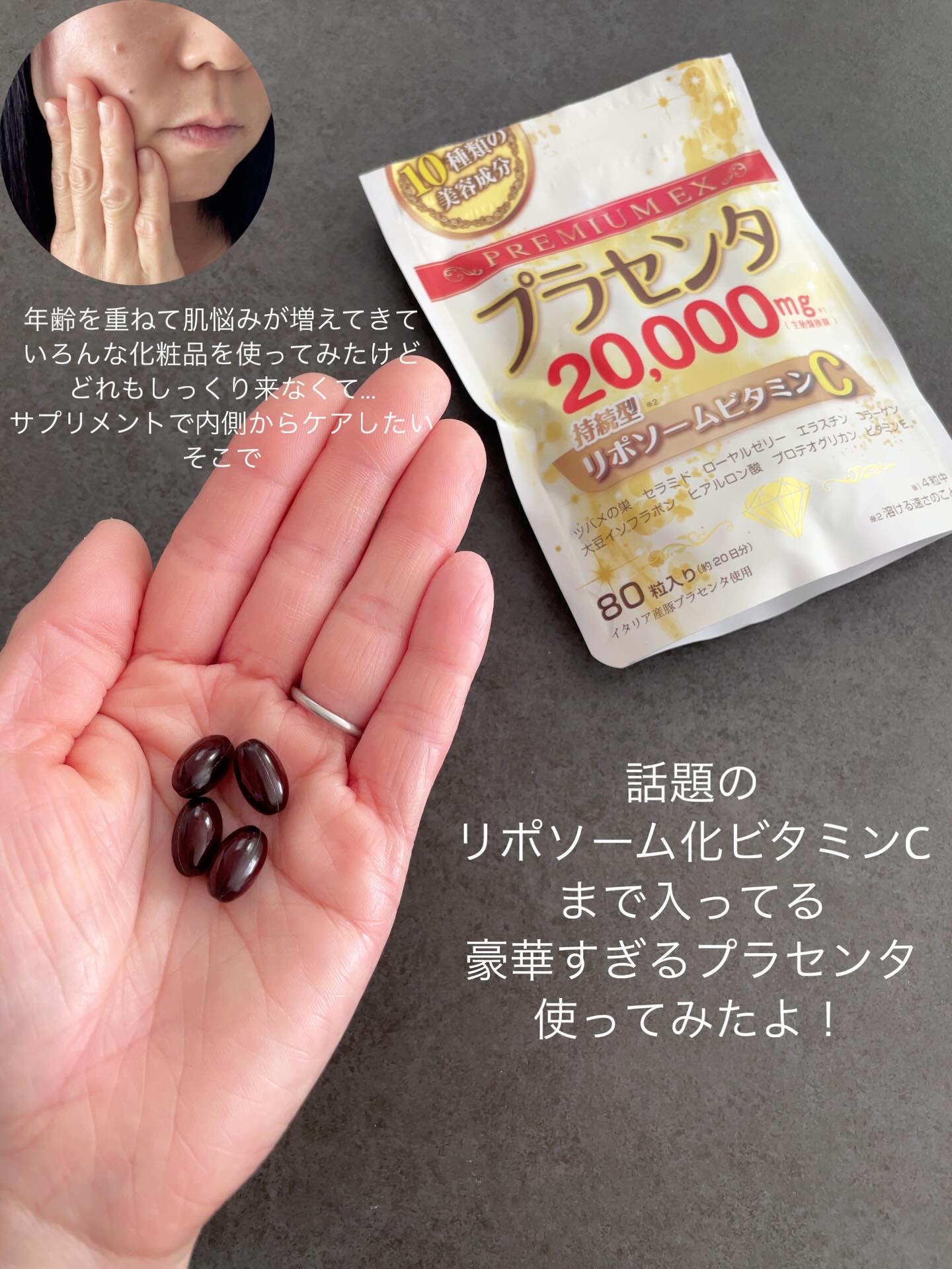 プラセンタ20000　リポソームビタミンC/マルマンH＆B/美容サプリメントを使ったクチコミ（2枚目）