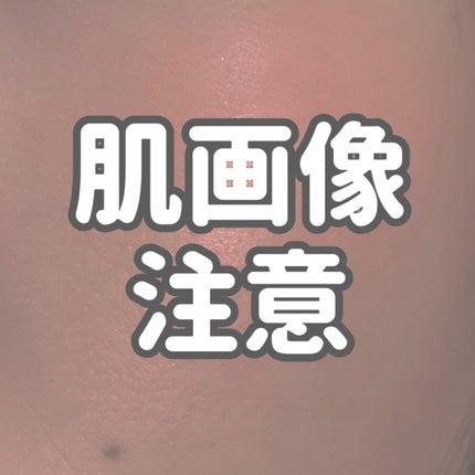 エッセンス スキングロウ ファンデーション/SHISEIDO/リキッドファンデーションを使ったクチコミ(1枚目)