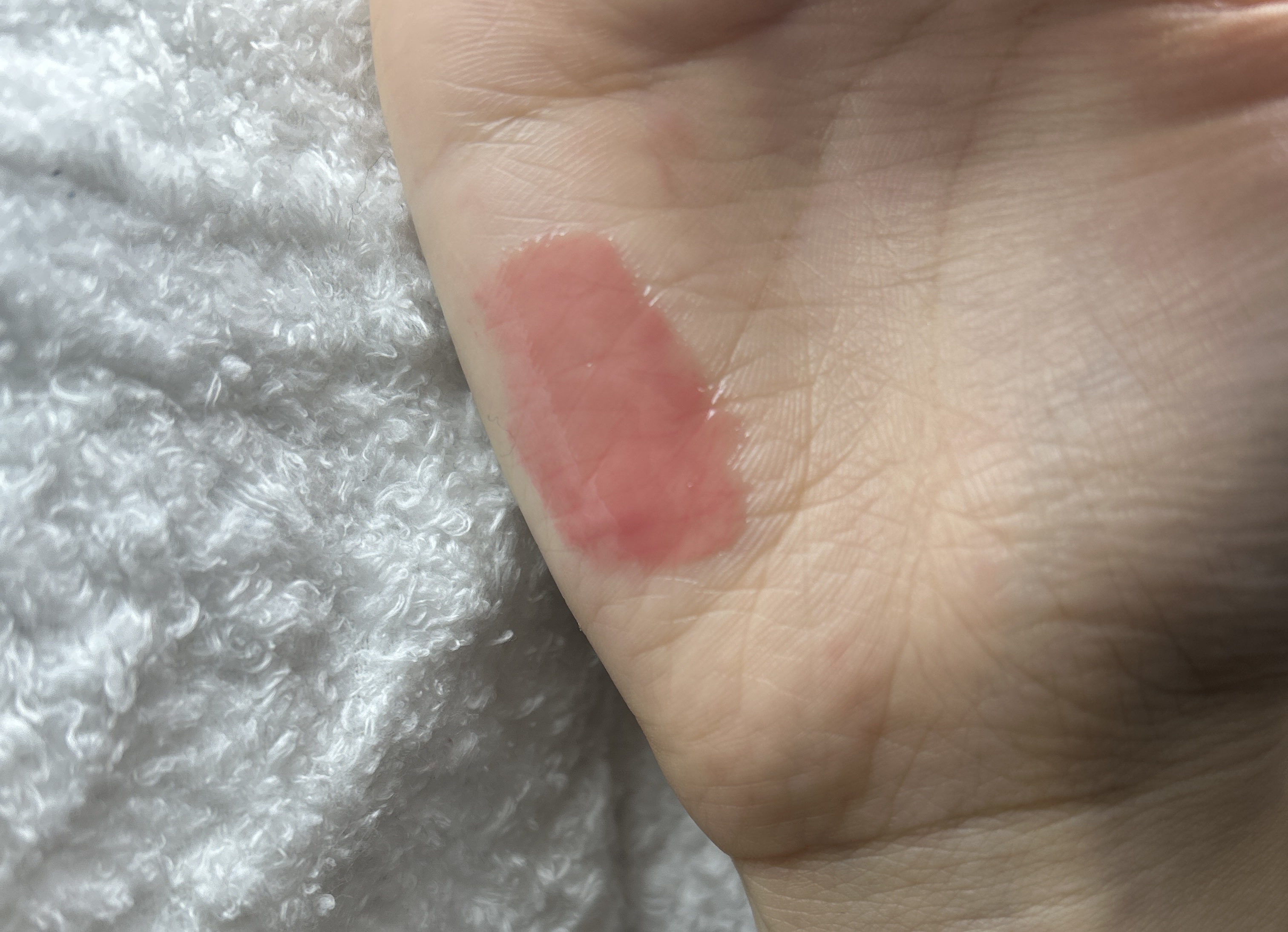 フィー 3Dボリューミンググロス/fwee/リップグロスを使ったクチコミ（3枚目）