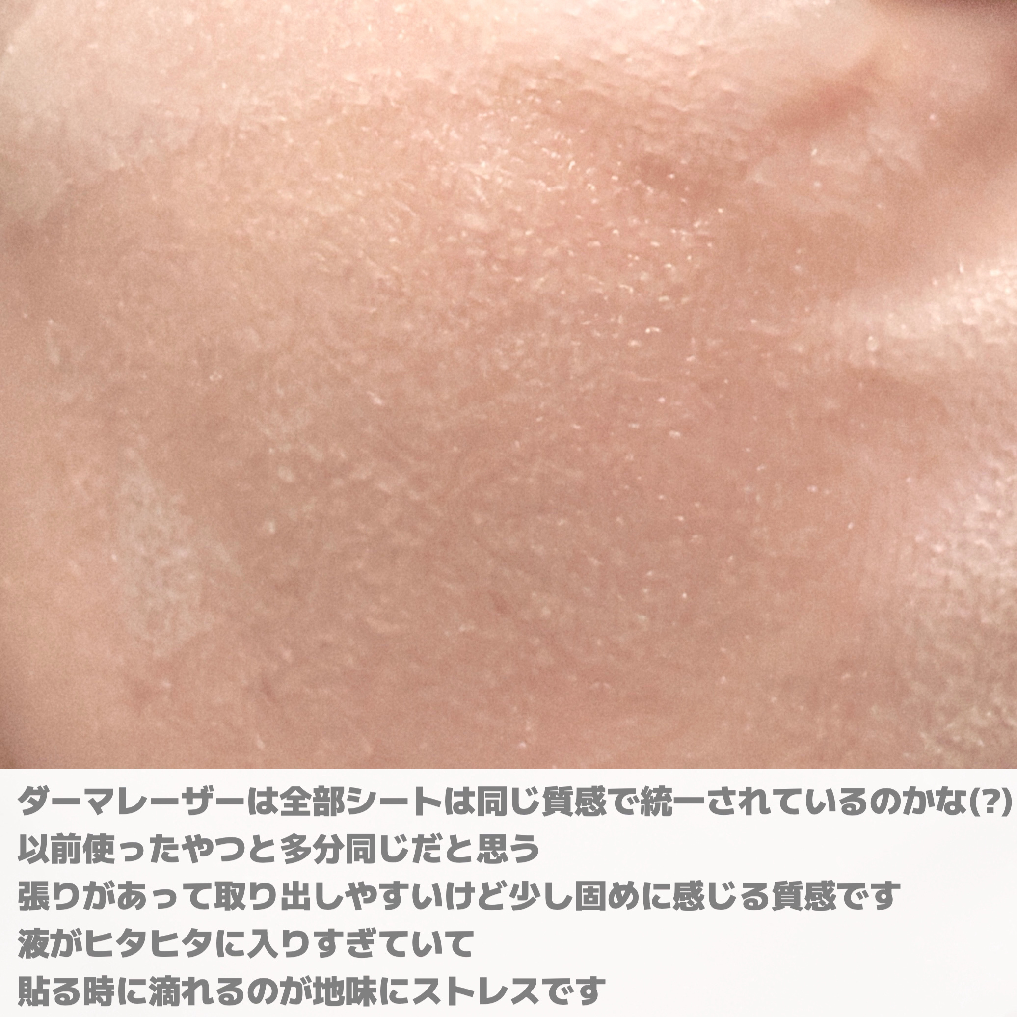 ダーマレーザースーパーVC100マスク/クオリティファースト/シートマスク・パックを使ったクチコミ（2枚目）