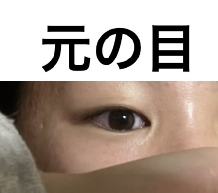 オリシキ アイリッドスキンフィルム EX/D-UP/二重まぶた用アイテムを使ったクチコミ（3枚目）