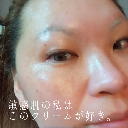 EPL キュアクリームXD/Dr.Oracle/フェイスクリームを使ったクチコミ(3枚目)