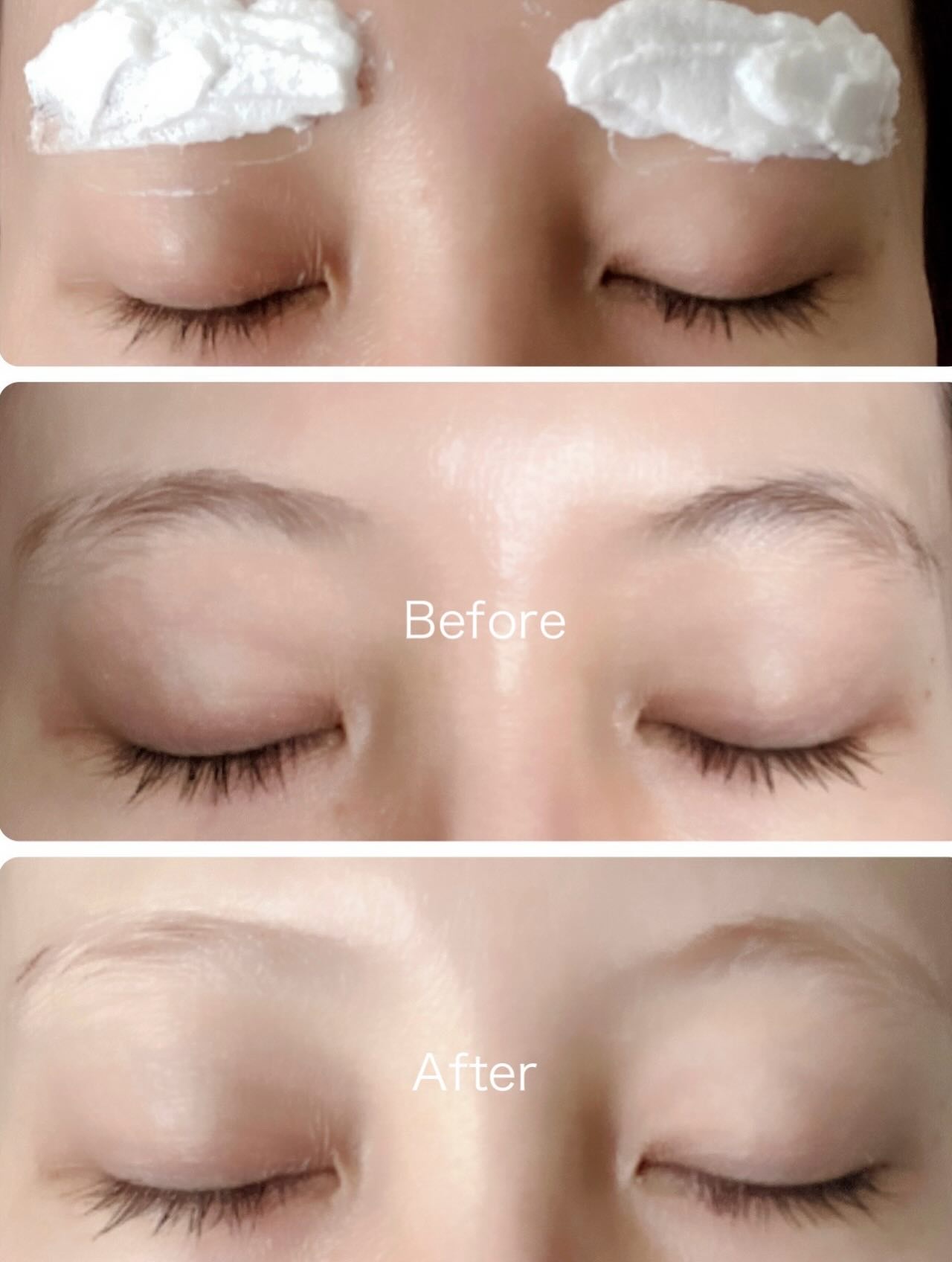 ジョレン クリーム ブリーチ/ジョレンジャパン/ムダ毛ケアを使ったクチコミ（3枚目）