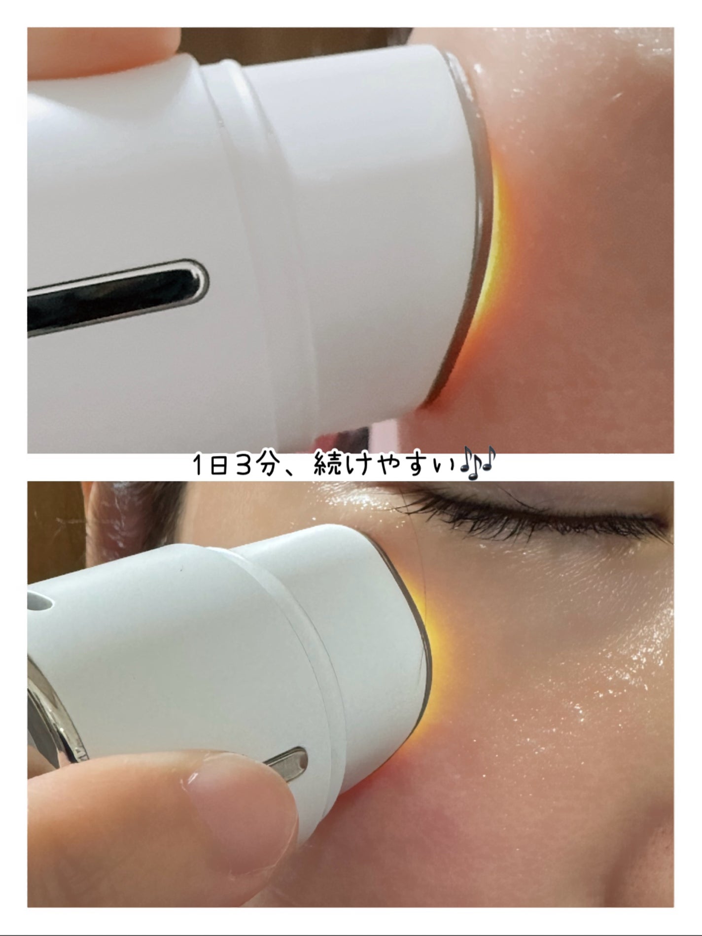 ディープトーニングクイックブースターショット/CNP Laboratory/美顔器・マッサージを使ったクチコミ(4枚目)