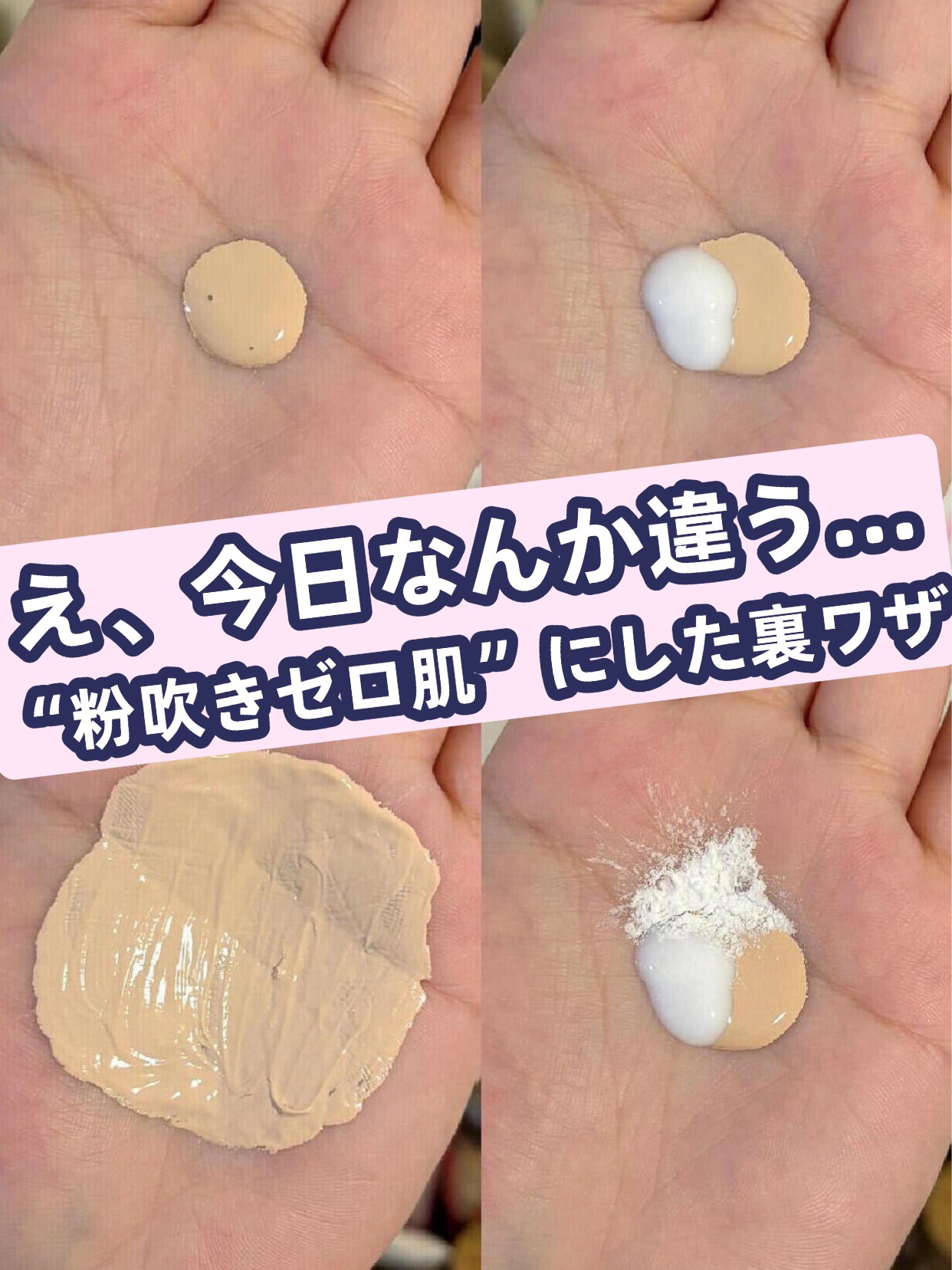 アネトス アクネケア トリートメント セラム/Anetos/美容液を使ったクチコミ（1枚目）