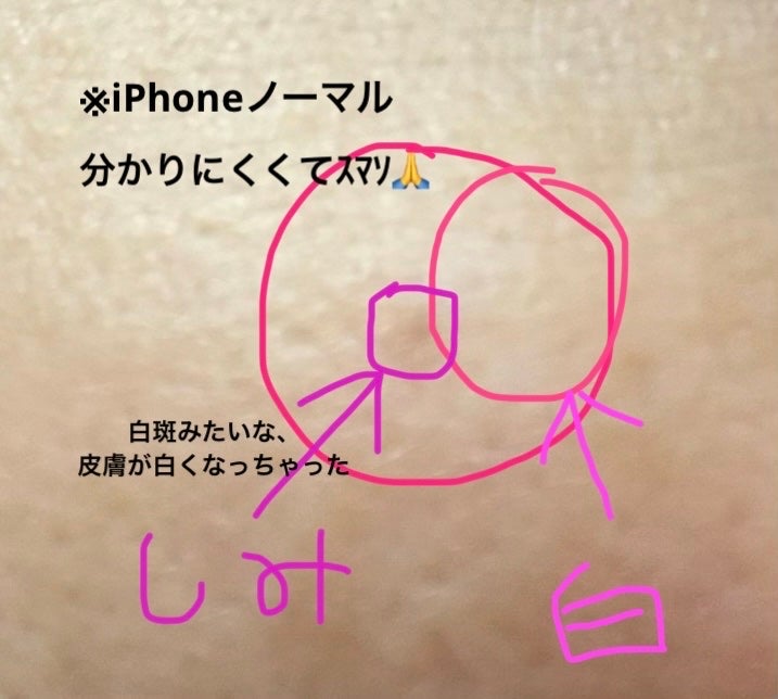 メラトニンクリーム/東亜製薬/フェイスクリームを使ったクチコミ(5枚目)