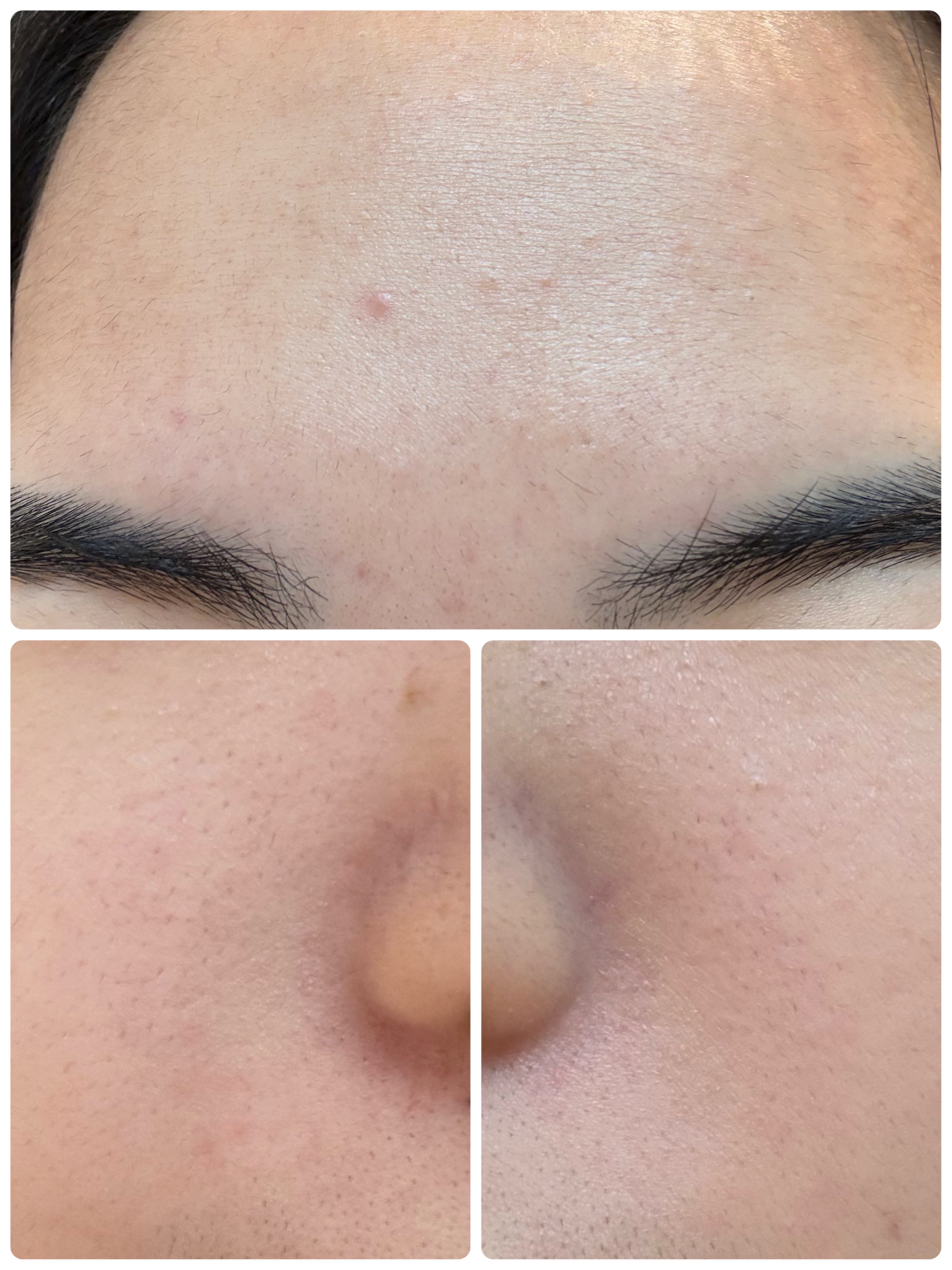 AGE-R ブースタープロ/MEDICUBE/美顔器・マッサージを使ったクチコミ（3枚目）