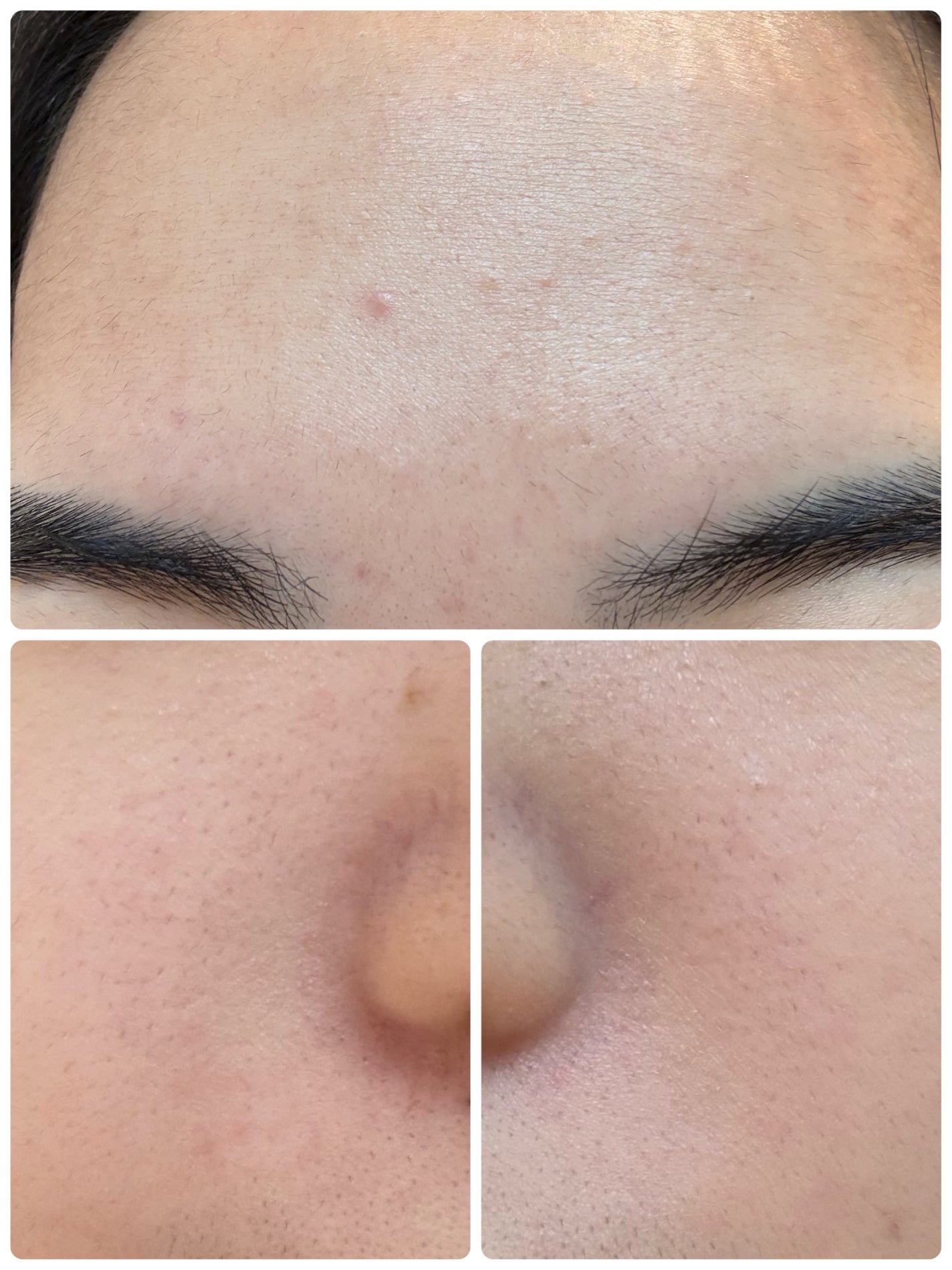 モーニングジェルウォッシュ/ビトレスキン/その他洗顔料を使ったクチコミ(3枚目)