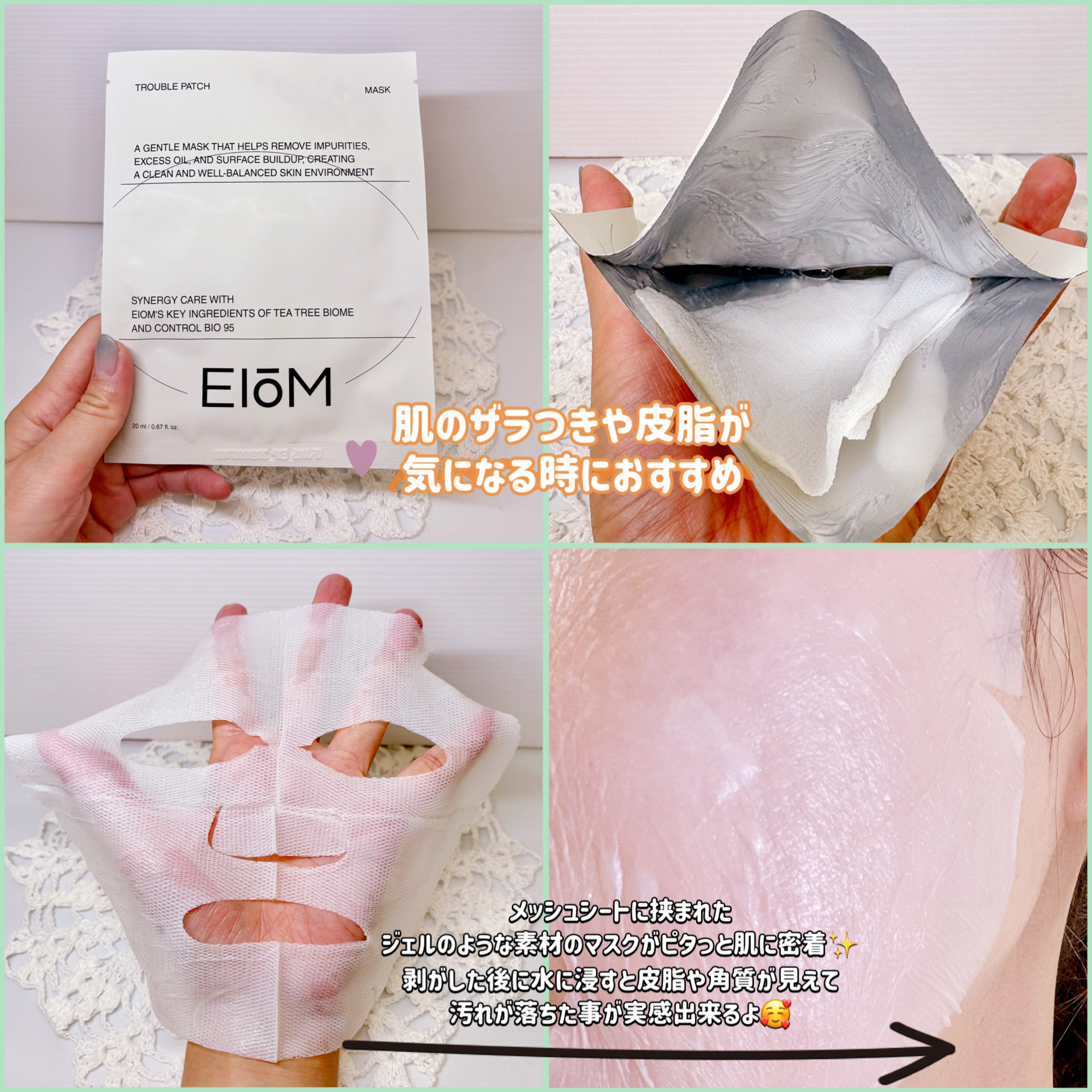 トラブルパッチマスク/EIOM/その他スキンケアを使ったクチコミ（3枚目）