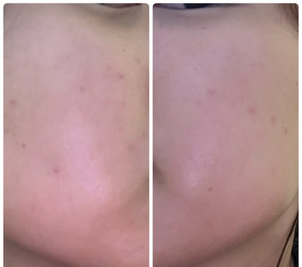 ぽむ on LIPS 「1枚目 2025.11.22エピデュオ 801日目2枚目 20..」(4枚目)