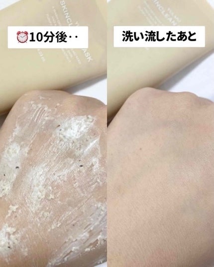ユルムスキンクリーンパック/RETURNITY/洗い流すパック・マスクを使ったクチコミ(3枚目)