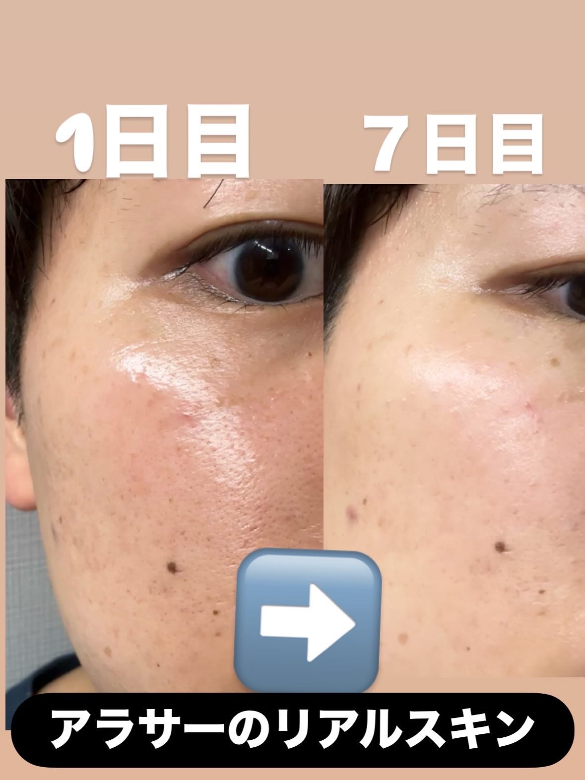 ミシャ ビタシープラス 薬用ブライトニング美容液/MISSHA/美容液を使ったクチコミ(6枚目)