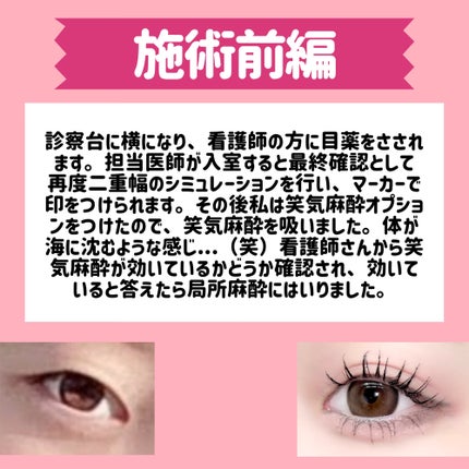 五月@正直レビュー on LIPS 「【水の森で二重埋没した結果📖】カウンセリング予約~術後まで全て..」(7枚目)