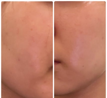 ぽむ on LIPS 「1枚目 2025.11.27エピデュオ 806日目2枚目 20..」(4枚目)